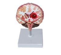 Medizinisches Trainingsset für Erwachsene, Lehrmodell des menschlichen Kopfes/Gehirns, Anatomie/Nackenmuskulatur, Nerven und Blutgefäße, medizinisches Lehrmittel, medizinische Modelle
