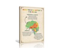 Mental Health Poster Brain Wall Art Therapy Office Decor How Trauma Affects The Brain Chart Poster Prints Contemporary Artwork(Framed,16x24inch(40x60cm))