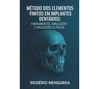 MÉTODO DOS ELEMENTOS FINITOS EM IMPLANTES DENTÁRIOS: FUNDAMENTOS, SIMULAÇÕES E APLICAÇÕES CLÍNICASMÉTODO DOS ELEMENTOS FINITOS EM IMPLANTES DENTÁRIOS