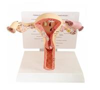 MiBoce Modelo Anatómico De Los Órganos Reproductores Femeninos, Modelo Patológico del Útero, Estudio Patológico del Útero Y Los Ovarios, para La Enseñanza Y La Formación Médica