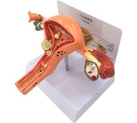 MiBoce Modelo De Útero Femenino Humano, Modelo Reproductivo Uterino Patológico, Modelo Didáctico De Útero Femenino Patológico, Modelo De Anatomía Genital Ovárica, Modelo Ginecológico