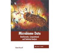 Microbiome Data: Bioinformatic, Computational and Statistical Analysis