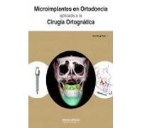 Microimplantes en Ortodoncia aplicada a la Cirugía Ortognática