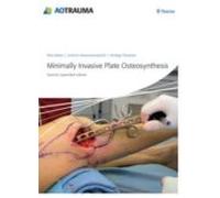 minimally invasive plate osteosynthesis (mipo) (2nd ed.)