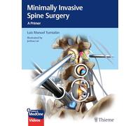 Cirugía mínimamente invasiva de la columna vertebral: una introducción – Thieme