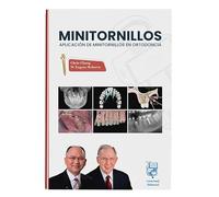 MINITORNILLOS: Aplicación de minitornillos en ortodoncia - Chris H. Chang / W. Eugene Roberts