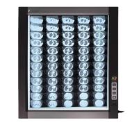 Mixtric Caja Luz para VisualizacióN RadiografíAs, Panel Luz Para VisualizacióN RadiografíAs, Visor Profesional con IluminacióN con Difusor óPtico AcríLico para Uso DoméStico Laboratorio,45*50*2.5cm