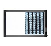 Mixtric Caja Luz para VisualizacióN RadiografíAs, Panel Luz Para VisualizacióN RadiografíAs, Visor Profesional con IluminacióN con Difusor óPtico AcríLico para Uso DoméStico Laboratorio,81*50*2.5cm