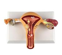Modelo humano femenino reproductor uterino vaginal ovárico uterino molde de enseñanza patología ciencia popular herramienta de capacitación