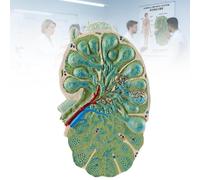 Modelo Anatómico de Ganglio Linfático Ampliado, Estructura Desmontable del Sistema Linfático, Demostración de Biología 3D para Escuela Secundaria, Aula Médica y Laboratorio