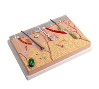 Modelo anatómico de la piel, estructura de la piel humana, modelo de anatomía, enseñanza médica para enfermedades, estudio, informe de conferencias médicas