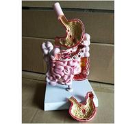 Modelo anatómico de órgano Humano Modelo de Enfermedad del Sistema digestivo Modelo patológico del tracto gastrointestinal Humano Modelo de anatomía del estómago Modelo de enseñanza para Mod