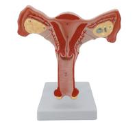 Modelo anatómico de órgano reproductivo interno femenino, modelo de ovario realista para enseñar