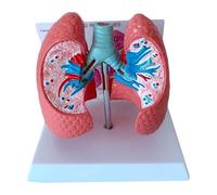 Modelo anatómico de patologías pulmonares, modelo anatómico de órganos humanos, tamaño real 1:1, demostración didáctica comparativa entre pulmón sano y pulmón patológico del sistema respiratorio.