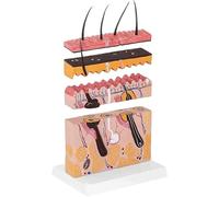 Modelo anatómico de piel humana, sección transversal dermatológica ampliada 3D, plástico de precisión médica para educación y estudio