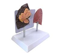 Modelo anatómico de pulmón y pulmón para la enseñanza de sustancias de PVC, demostración clínica en el aula, juego de demostración clínica