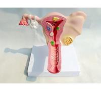 Modelo anatómico de útero y ovario humano, modelo de enseñanza de anatomía vaginal del sistema reproductor femenino, material didáctico de anatomía de ovario de ginecología