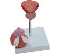 Modelo anatómico de vejiga y próstata humana, modelo didáctico de órganos del sistema urinario masculino, modelo de órgano humano, desmontable en 2 partes, for exhibición en educación médica