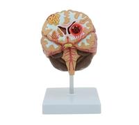 Modelo anatómico del cerebro humano, ayuda a la enseñanza de neurología a escala 1:1, modelo de accidente cerebrovascular y patología cerebral para educación médica y demostración
