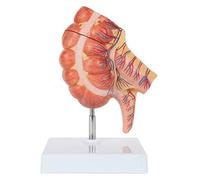 Modelo anatómico del ciego y el apéndice humano, agrandado 1,5 veces. detallado intestino grueso con válvula ileocecal