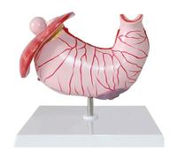 Modelo anatómico del estómago Humano Modelo estomacal Modelo del Sistema digestivo Modelo Educativo Modelo de Gastritis Modelo de lesión gástrica Patología gástrica Gastritis Modelo médico