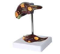 Modelo anatómico del hígado humano de enfermedad, for ayuda a la formación educativa médica