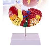 Modelo anatómico del hígado humano, Modelo didáctico de patología hepática con textura transparente, Modelo versátil y brillante del hígado para la enseñanza de ciencias Modelos de estudio