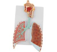 Modelo anatómico del respiratorio humano: representación detallada de los alvéolos y el árbol bronquial con fines educativos.