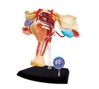 Modelo anatómico del sistema reproductor femenino de 19 partes. Incluye útero y estructuras ováricas extraíbles for formación en ginecología