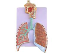 Modelo anatómico del sistema respiratorio humano, alvéolos detallados y árbol bronquial para el estudio educativo de los pulmones y el tracto respiratorio