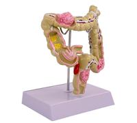 Modelo Anatómico Humano Modelo Humano De Intestino Grande Patologías Humanas Del Modelo Intestinal Grande Para La Educación Científica Modelo De Anatomía Humana Para Estudio Escolar Humano