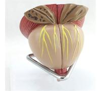 Modelo anatómico Masculino de próstata a tamaño Real. Modelo de órgano prostático Humano Desmontable en 4 Partes. Material didáctico for la enseñanza y el Aprendizaje.
