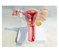 Modelo anatómico, Modelo anatómico del órgano genital femenino, útero y ovarios, ginecología