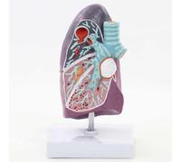 Modelo anatómico, Modelo, Modelo de cáncer de Lu 2:3 con características y Textura Clara y precisa para y