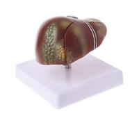 Modelo anatómico patológico del hígado humano, anatomía, escuela, enseñanza médica, displa modelos de enseñanza
