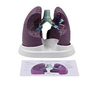 Modelo anatómico patológico pulmonar normal y patológico modelo de anatomía pulmonar para enseñanza de investigación, entornos clínicos, equipo de educación sanitaria