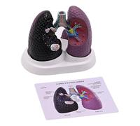 Modelo anatómico patológico pulmonar normal y patológico modelo de anatomía pulmonar para enseñar investigación, entornos clínicos, visualización de educación sanitaria