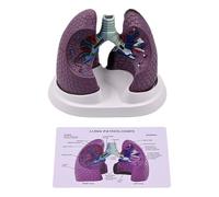 Modelo anatómico patológico pulmonar normal y patológico modelo de anatomía pulmonar para enseñar investigación, entornos clínicos, visualización de educación sanitaria