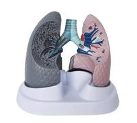 Modelo anatómico pulmonar de doble cara, comparación pulmonar sano/pulmón enfermo, réplica desmontable para consultorio médico, herramienta educativa Humano Desmontable