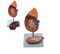 Modelo Anatómico Renal Humana 1,5 Veces Más Grande Con Base de Visualización Digital, Modelo de Órgano Renal Humano Réplica para la Comunicación Médico-Paciente