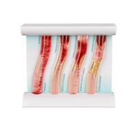 Modelo Arterias Humanas 4 Piezas para Enseñanza Comparativa | Modelo Vascular Simulado para Circulación y Arteriosclerosis en Anatomía y Fisiología