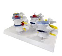 Modelo combinado de cuatro puntos lumbar normal y lumbar con lesión. Modelo médico anatómico lumbar humano. moldes de enseñanza