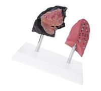 Modelo comparativo "Puffing Lung vs " para la formación clínica Estructura de PVC permanente Material didáctico Comparación de la educación sanitaria