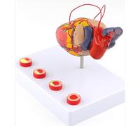 Modelo Corazón 1:1 Desmontable con Bypass y Trombosis para Aprender | Modelo Realista y Anatómicamente Preciso de Corazón Humano con 34 Señales Digitales para la Enseñanza en el Aula