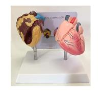 Modelo corazón humano, modelo comparación corazón fumador y corazón sano,