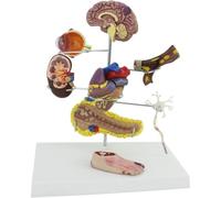 Modelo de Anatomía de Complicaciones de la Diabetes Humana, Conjunto Completo de Órganos con Cerebro, Corazón, Páncreas, Nervio y Estructura del Pie para Educación Médica