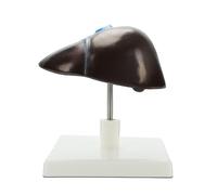 Modelo de anatomía de estructura hepática, hígado humano anatómico de tamaño natural para enseñanza, investigación, entornos clínicos, enseñanza del hígado