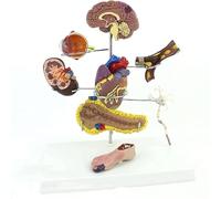 Modelo de anatomía de la diabetes - 8 piezas para comunicación médico-paciente, herramienta educativa de complicaciones patológicas