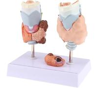 Modelo de anatomía de la tiroides humana, modelo médico de patología de tiroides desmontable de tamaño natural de 4 partes, con base de soporte, for fisiología de educación de estudios