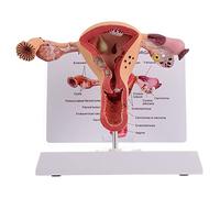 Modelo de anatomía de órganos reproductivos femeninos: estudio patológico detallado del útero y el ovario para educación médica y formación